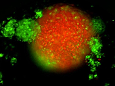 TNBC 3D spheroid expressing Kate2 (red) under attack by activated T cells (green)