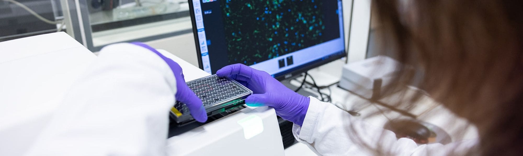 Cell-based assays - Oncodesign Services