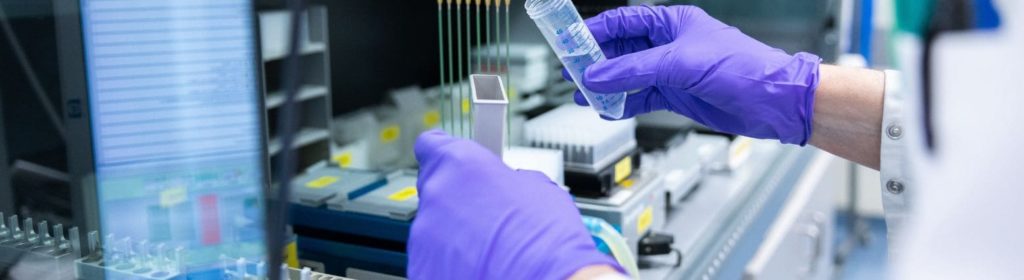 Metastatic Models | Oncodesign Services